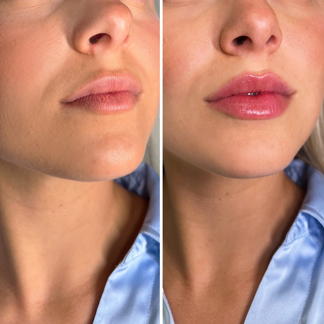 LIP BOOSTER SERUM BY PLUMP CARE®